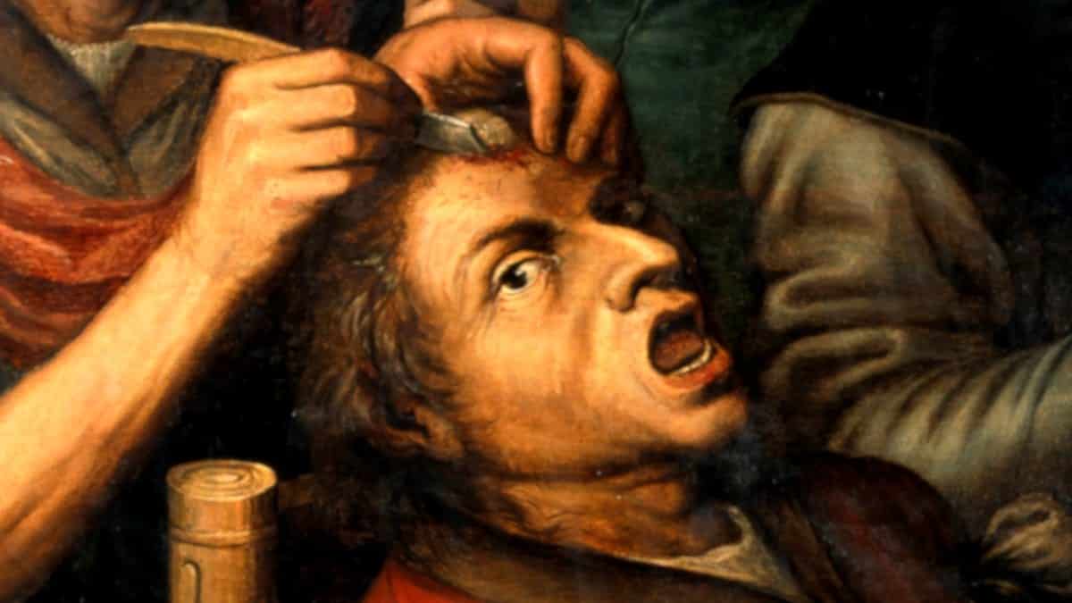 Idade Média tratamentos absurdos